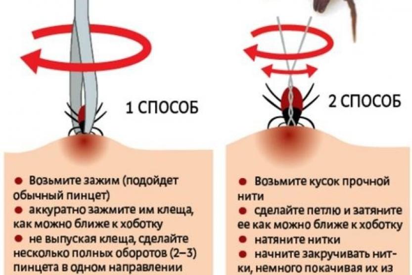 Удалить клеща у собаки самостоятельно. Как убрать клеща с человека ниткой. Как вытащить клеща у человека в домашних условиях правильно. Как удалить клеща у человека ниткой. Удалить клеща ниткой у человека.