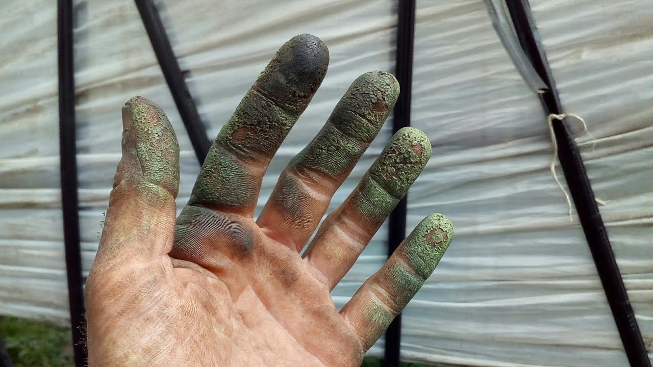 Чем отмыть руки от грязи. Руки после зеленых грецких орехов. Руки после грецких орехов фото.