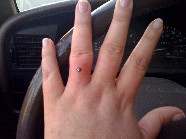 Почему чернеет золотое кольцо на руке. Черное кольцо на пальце. Отпечаток от кольца на пальце.
